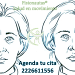 paralisis facial